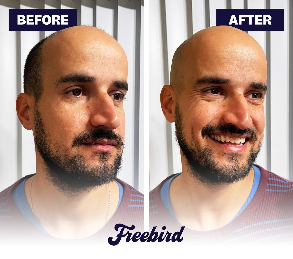 FlexSeries® Shaving Kit
